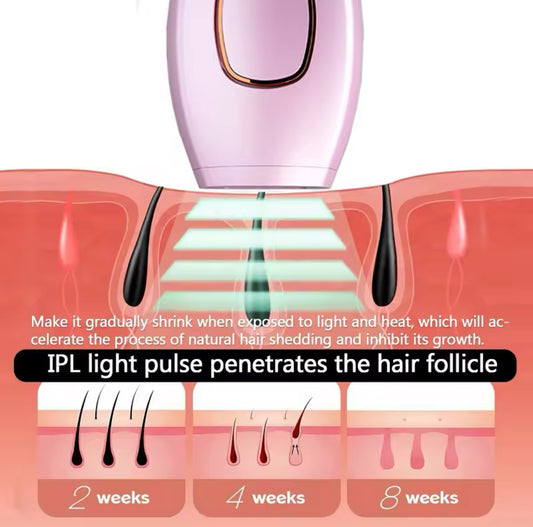 Depiladora Láser IPL – Piel Suave, Segura y Libre de Vello para Siempre